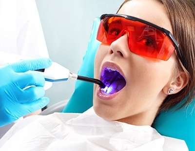 Avoid risk of cavities with dental sealants