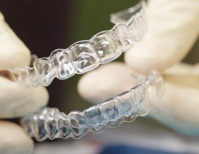 Clear Aligners