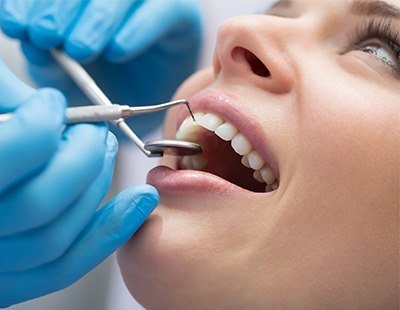 Scaling and root planing is focused on gum line and roots of the teeth and helps avoid gum disease