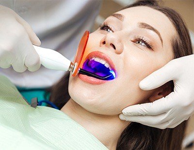 Small stain, chip or gap can be removed using dental bonding