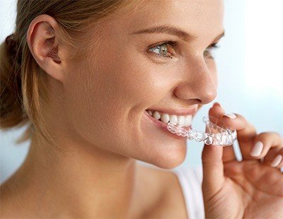 Invisalign nearly invisible aligners