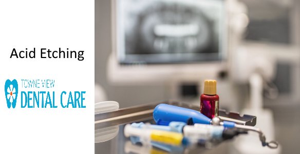 What is the Definition of Acid Etching?