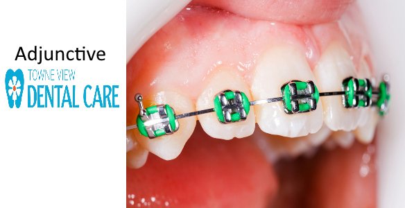 What is a Dental Adjunctive Procedure?