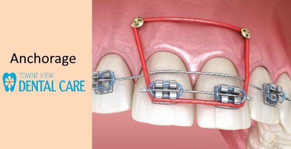 Anchorage Definition