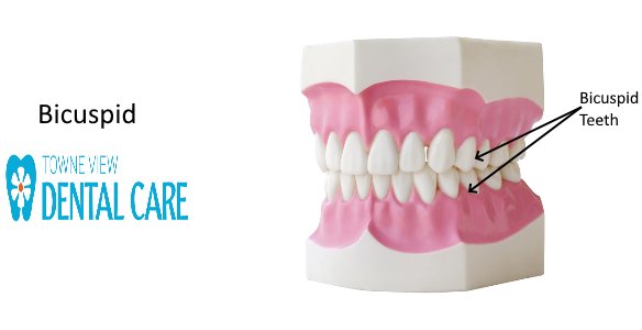 Bicuspid Tooth Definition
